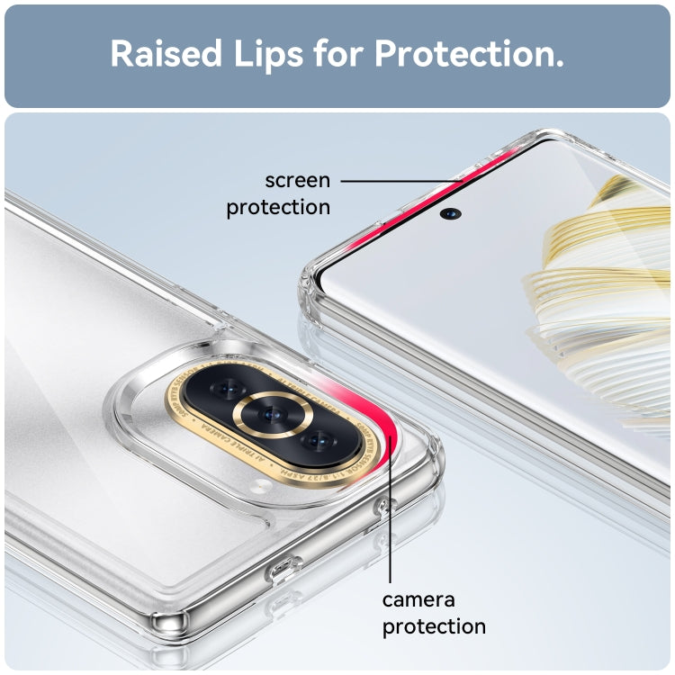 Colorful Series Acrylic + TPU Phone Case, For Huawei nova 10, For Huawei nova 10 Pro