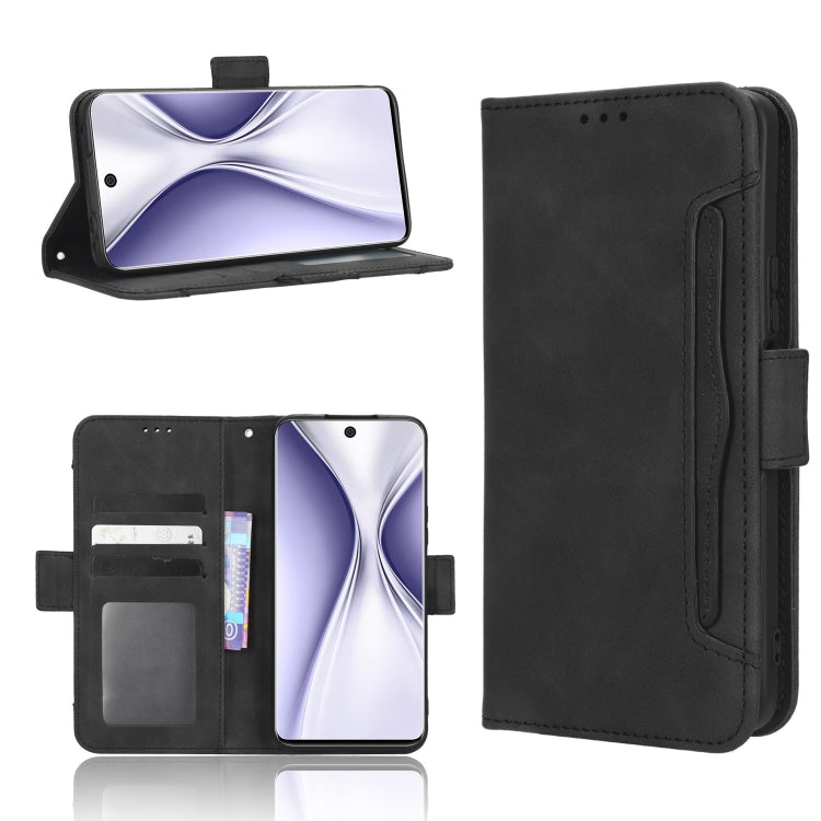 Skin Feel Calf Texture Card Slots Leather Phone Case, For Honor Play 6C / X8 5G / X6 4G, For Honor X20 SE / Huawei nova 10z, For Xiaomi 12T Pro, For Xiaomi Civi 2 5G / 12 Lite NE, For Umidigi G1
