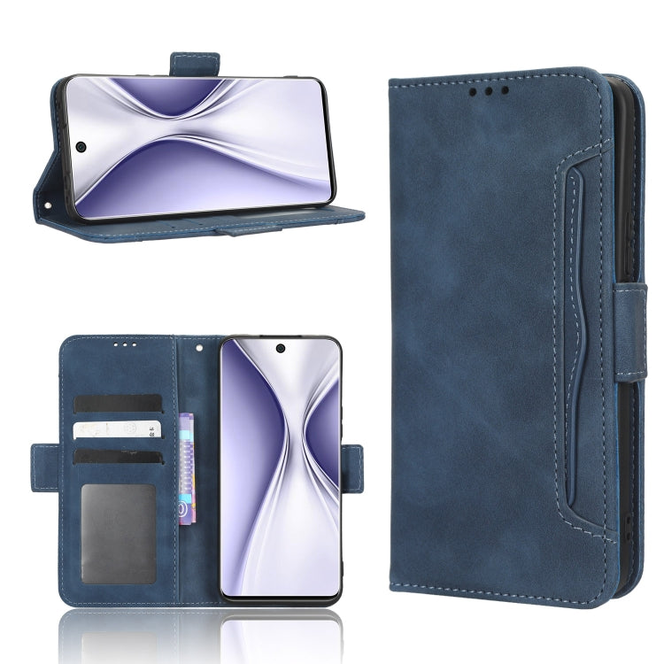 Skin Feel Calf Texture Card Slots Leather Phone Case, For Honor Play 6C / X8 5G / X6 4G, For Honor X20 SE / Huawei nova 10z, For Xiaomi 12T Pro, For Xiaomi Civi 2 5G / 12 Lite NE, For Umidigi G1