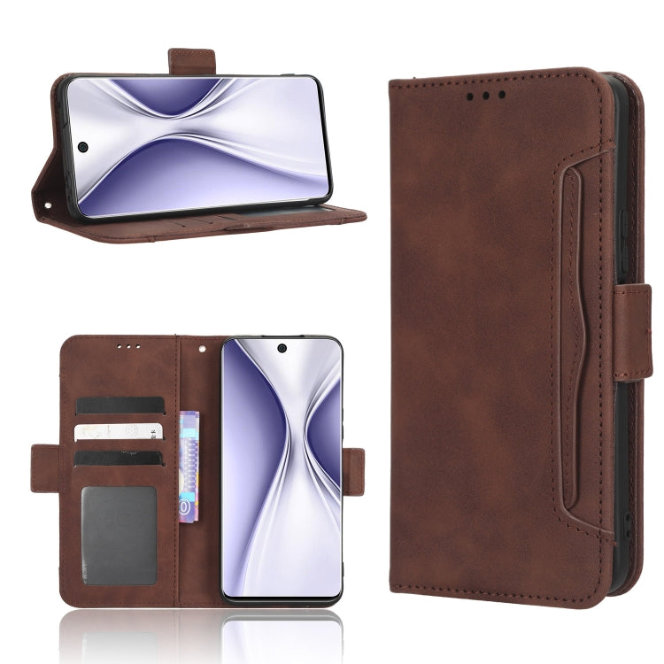 Skin Feel Calf Texture Card Slots Leather Phone Case, For Honor Play 6C / X8 5G / X6 4G, For Honor X20 SE / Huawei nova 10z, For Xiaomi 12T Pro, For Xiaomi Civi 2 5G / 12 Lite NE, For Umidigi G1