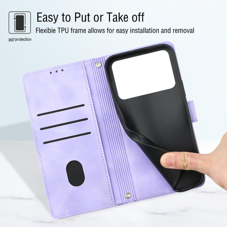 Skin-feel Embossed Leather Phone Case, For Xiaomi Poco X4 Pro 5G, For Xiaomi Redmi 10 2022 / Note 11 4G, For Xiaomi Redmi 10 Prime+ 5G, For Xiaomi Redmi 10A, For Xiaomi Redmi 10C 4G, For Xiaomi Redmi A1, For Xiaomi Redmi K50 Pro / K50                  ...