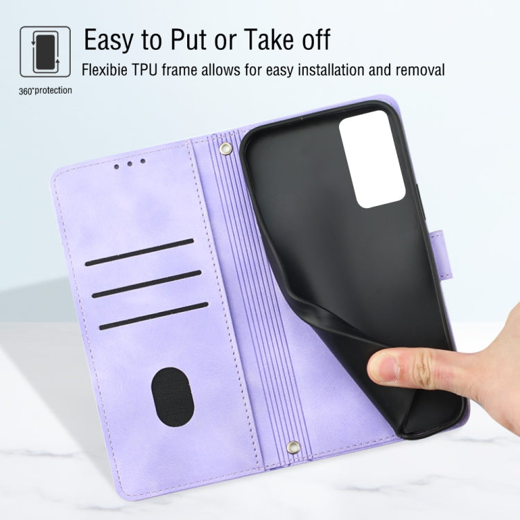 Skin-feel Embossed Leather Phone Case, For Xiaomi Redmi Note 11 Pro 5G / 4G, For Xiaomi Redmi Note 11s / 11 4G, For Xiaomi Redmi Note 11T Pro 5G / 11T Pro+ 5G