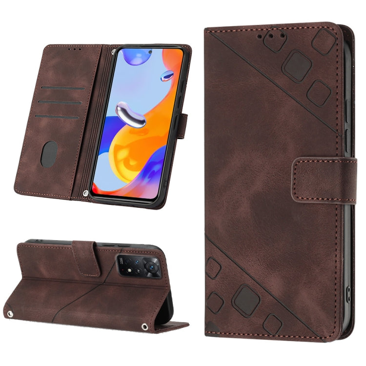 Skin-feel Embossed Leather Phone Case, For Xiaomi Redmi Note 11 Pro 5G / 4G, For Xiaomi Redmi Note 11s / 11 4G, For Xiaomi Redmi Note 11T Pro 5G / 11T Pro+ 5G