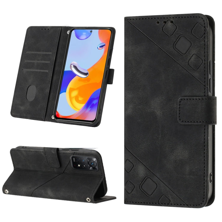 Skin-feel Embossed Leather Phone Case, For Xiaomi Redmi Note 11 Pro 5G / 4G, For Xiaomi Redmi Note 11s / 11 4G, For Xiaomi Redmi Note 11T Pro 5G / 11T Pro+ 5G