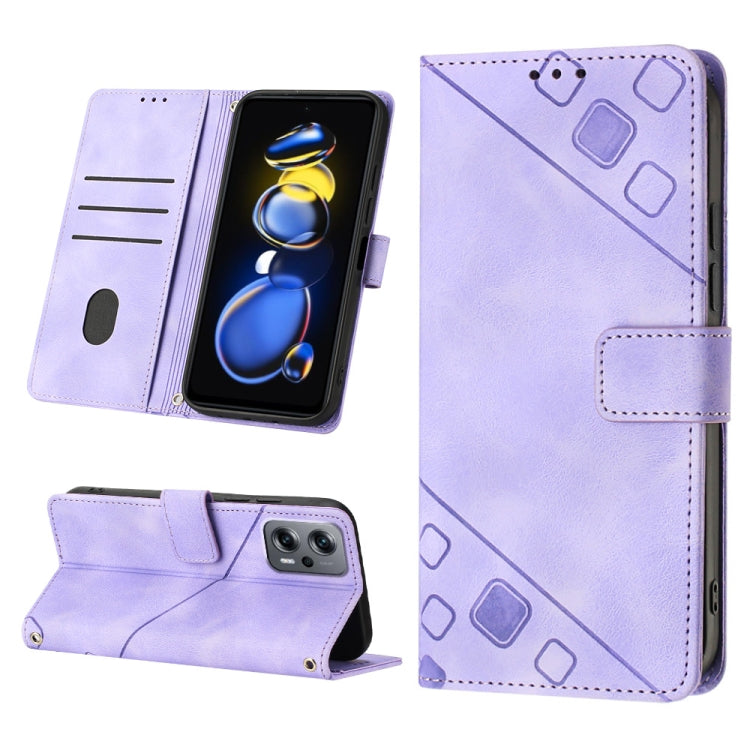 Skin-feel Embossed Leather Phone Case, For Xiaomi Redmi Note 11 Pro 5G / 4G, For Xiaomi Redmi Note 11s / 11 4G, For Xiaomi Redmi Note 11T Pro 5G / 11T Pro+ 5G