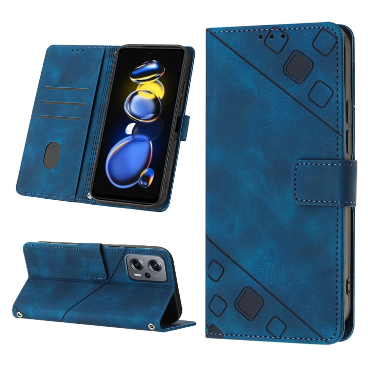 Skin-feel Embossed Leather Phone Case, For Xiaomi Redmi Note 11 Pro 5G / 4G, For Xiaomi Redmi Note 11s / 11 4G, For Xiaomi Redmi Note 11T Pro 5G / 11T Pro+ 5G