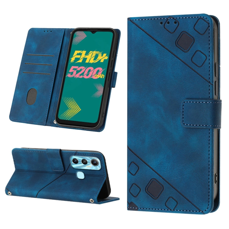 Skin-feel Embossed Leather Phone Case, For Infinix Hot 11, For Infinix Hot 11 Play / Hot 10 Play, For Infinix Hot 11s, For Infinix Hot 11s NFC X6812B, For Infinix Hot 12 Play / Hot 12 Play NFC, For Infinix Hot 12i X665, For Infinix Hot 12 X6817        ...