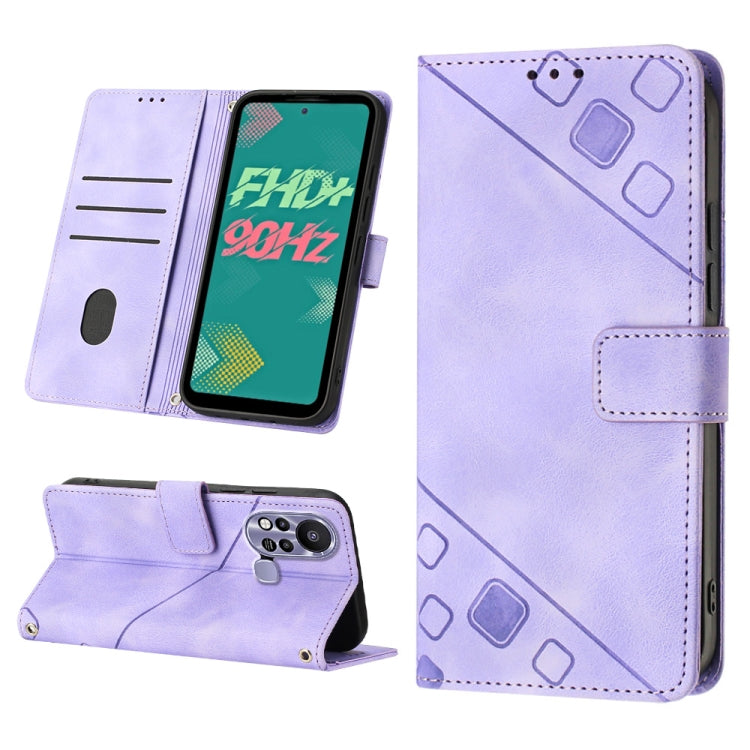 Skin-feel Embossed Leather Phone Case, For Infinix Hot 11, For Infinix Hot 11 Play / Hot 10 Play, For Infinix Hot 11s, For Infinix Hot 11s NFC X6812B, For Infinix Hot 12 Play / Hot 12 Play NFC, For Infinix Hot 12i X665, For Infinix Hot 12 X6817        ...