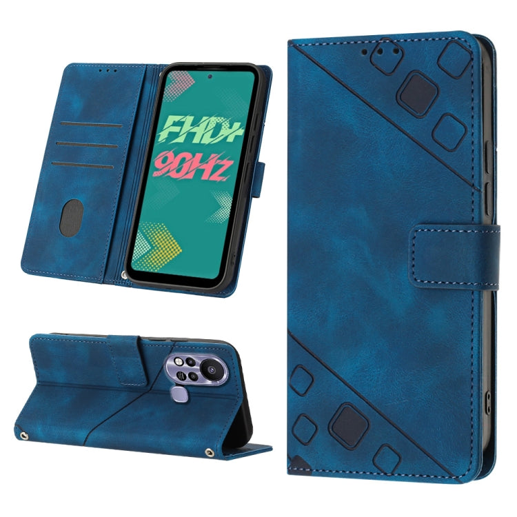 Skin-feel Embossed Leather Phone Case, For Infinix Hot 11, For Infinix Hot 11 Play / Hot 10 Play, For Infinix Hot 11s, For Infinix Hot 11s NFC X6812B, For Infinix Hot 12 Play / Hot 12 Play NFC, For Infinix Hot 12i X665, For Infinix Hot 12 X6817        ...