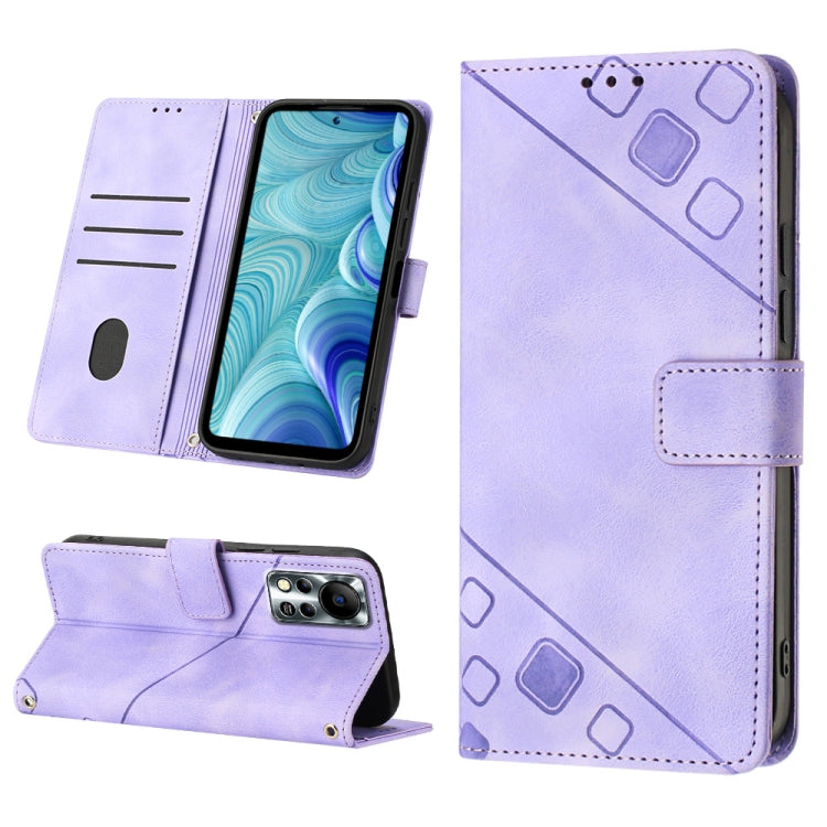 Skin-feel Embossed Leather Phone Case, For Infinix Hot 11, For Infinix Hot 11 Play / Hot 10 Play, For Infinix Hot 11s, For Infinix Hot 11s NFC X6812B, For Infinix Hot 12 Play / Hot 12 Play NFC, For Infinix Hot 12i X665, For Infinix Hot 12 X6817        ...