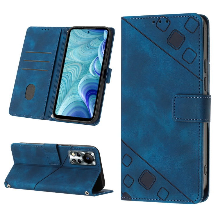 Skin-feel Embossed Leather Phone Case, For Infinix Hot 11, For Infinix Hot 11 Play / Hot 10 Play, For Infinix Hot 11s, For Infinix Hot 11s NFC X6812B, For Infinix Hot 12 Play / Hot 12 Play NFC, For Infinix Hot 12i X665, For Infinix Hot 12 X6817        ...