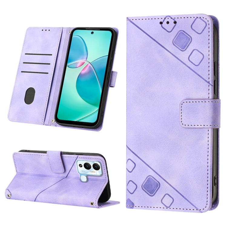 Skin-feel Embossed Leather Phone Case, For Infinix Hot 11, For Infinix Hot 11 Play / Hot 10 Play, For Infinix Hot 11s, For Infinix Hot 11s NFC X6812B, For Infinix Hot 12 Play / Hot 12 Play NFC, For Infinix Hot 12i X665, For Infinix Hot 12 X6817        ...