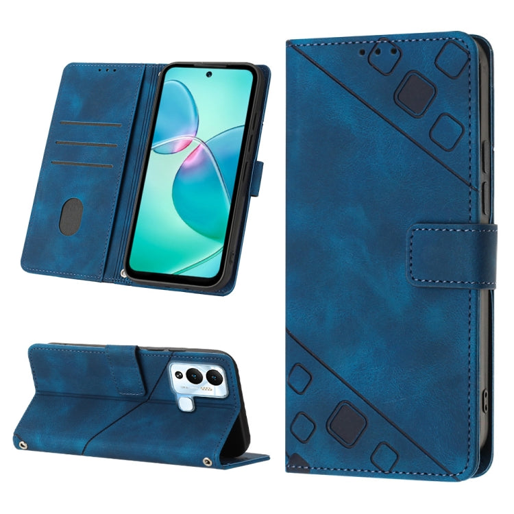 Skin-feel Embossed Leather Phone Case, For Infinix Hot 11, For Infinix Hot 11 Play / Hot 10 Play, For Infinix Hot 11s, For Infinix Hot 11s NFC X6812B, For Infinix Hot 12 Play / Hot 12 Play NFC, For Infinix Hot 12i X665, For Infinix Hot 12 X6817        ...