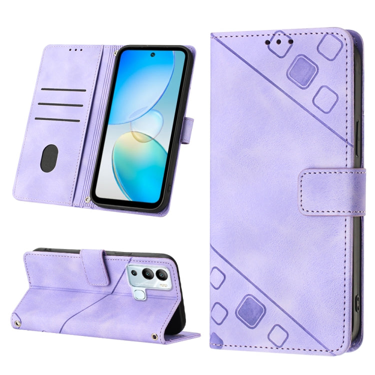 Skin-feel Embossed Leather Phone Case, For Infinix Hot 11, For Infinix Hot 11 Play / Hot 10 Play, For Infinix Hot 11s, For Infinix Hot 11s NFC X6812B, For Infinix Hot 12 Play / Hot 12 Play NFC, For Infinix Hot 12i X665, For Infinix Hot 12 X6817        ...