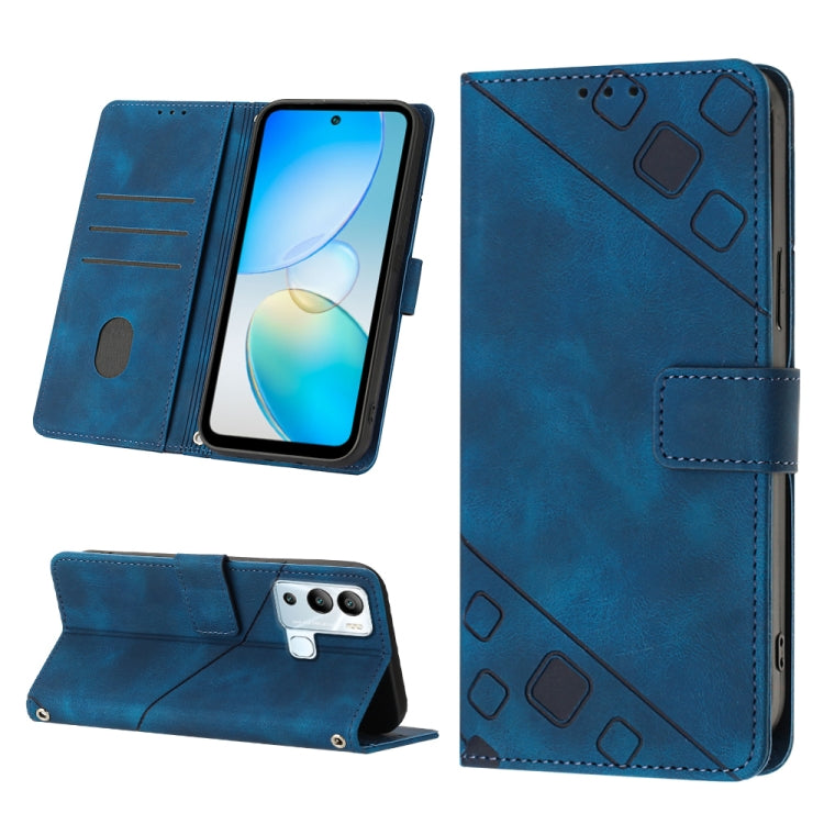 Skin-feel Embossed Leather Phone Case, For Infinix Hot 11, For Infinix Hot 11 Play / Hot 10 Play, For Infinix Hot 11s, For Infinix Hot 11s NFC X6812B, For Infinix Hot 12 Play / Hot 12 Play NFC, For Infinix Hot 12i X665, For Infinix Hot 12 X6817        ...