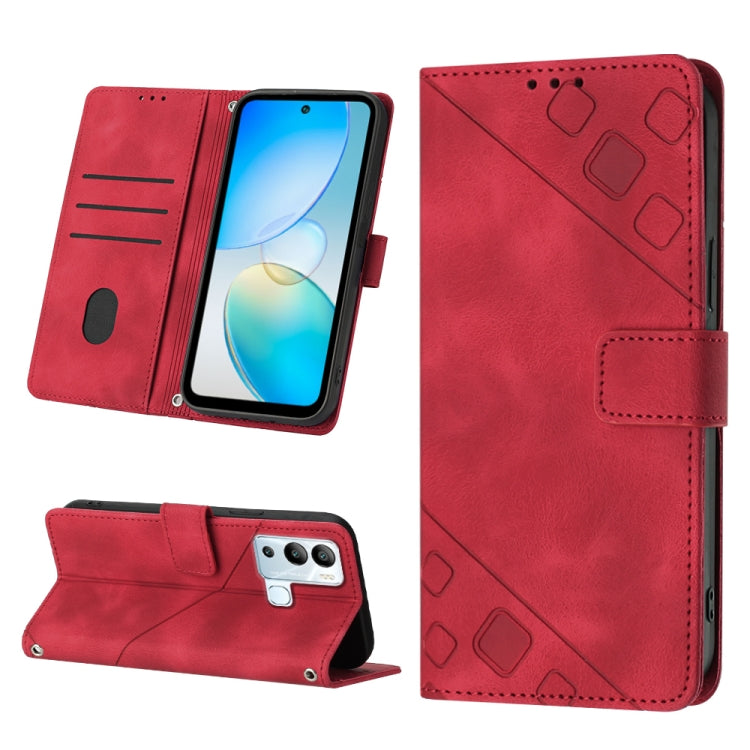 Skin-feel Embossed Leather Phone Case, For Infinix Hot 11, For Infinix Hot 11 Play / Hot 10 Play, For Infinix Hot 11s, For Infinix Hot 11s NFC X6812B, For Infinix Hot 12 Play / Hot 12 Play NFC, For Infinix Hot 12i X665, For Infinix Hot 12 X6817        ...