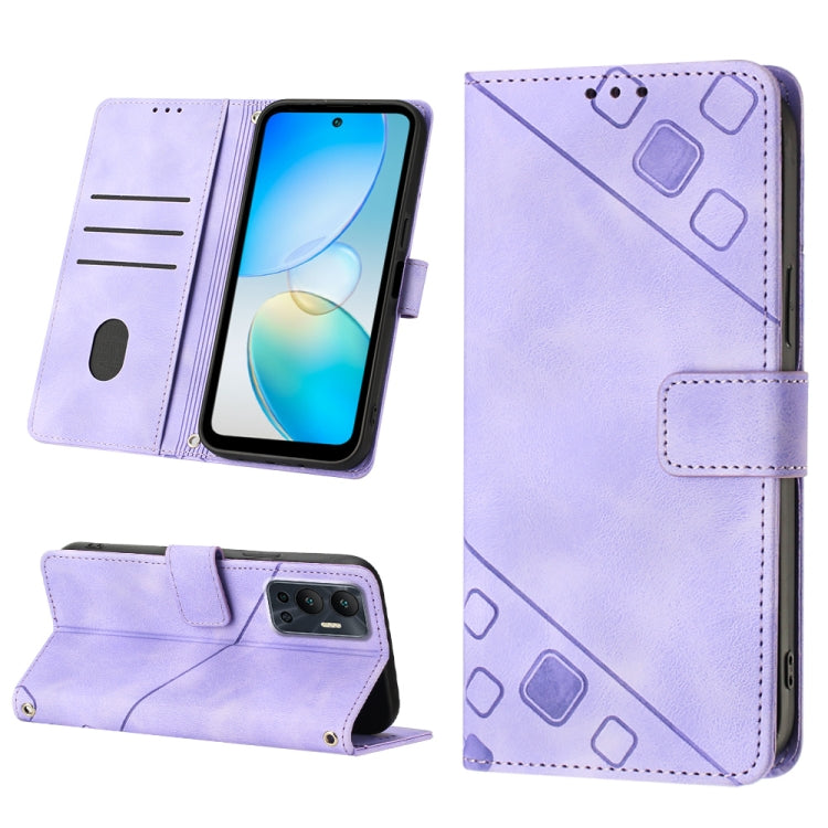 Skin-feel Embossed Leather Phone Case, For Infinix Hot 11, For Infinix Hot 11 Play / Hot 10 Play, For Infinix Hot 11s, For Infinix Hot 11s NFC X6812B, For Infinix Hot 12 Play / Hot 12 Play NFC, For Infinix Hot 12i X665, For Infinix Hot 12 X6817        ...