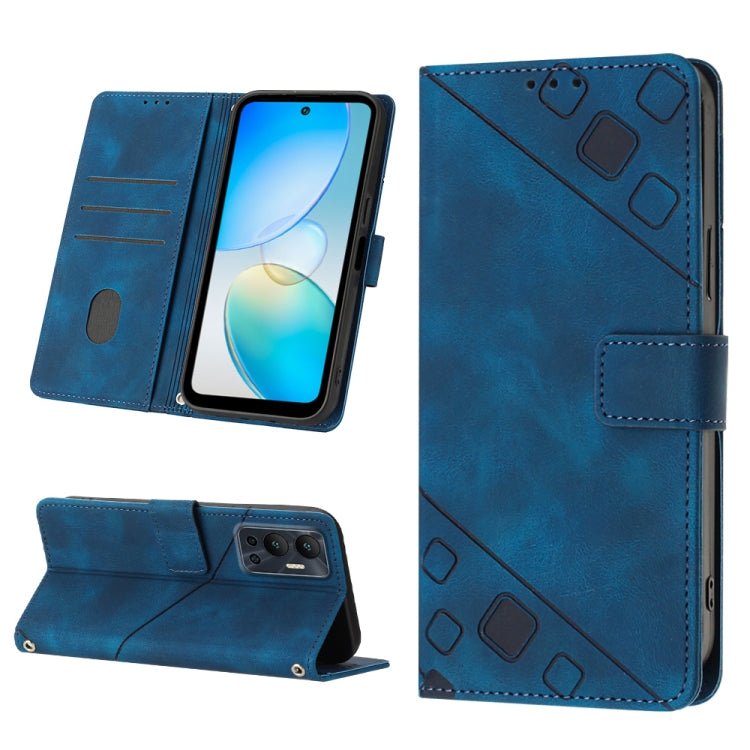 Skin-feel Embossed Leather Phone Case, For Infinix Hot 11, For Infinix Hot 11 Play / Hot 10 Play, For Infinix Hot 11s, For Infinix Hot 11s NFC X6812B, For Infinix Hot 12 Play / Hot 12 Play NFC, For Infinix Hot 12i X665, For Infinix Hot 12 X6817        ...