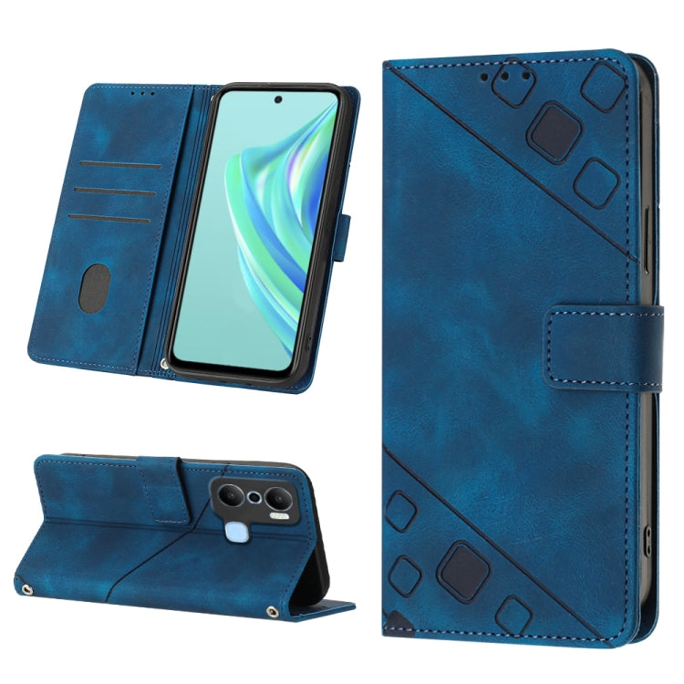 Skin-feel Embossed Leather Phone Case, For Infinix Hot 20 5G X666, For Infinix Hot 20 Play, For Infinix Hot 20S / 20 Pro X6827, For Infinix Note 11, For Infinix Note 11i / Note 10, For Infinix Note 11s / Note 11 Pro, For Infinix Note 12 G96            ...