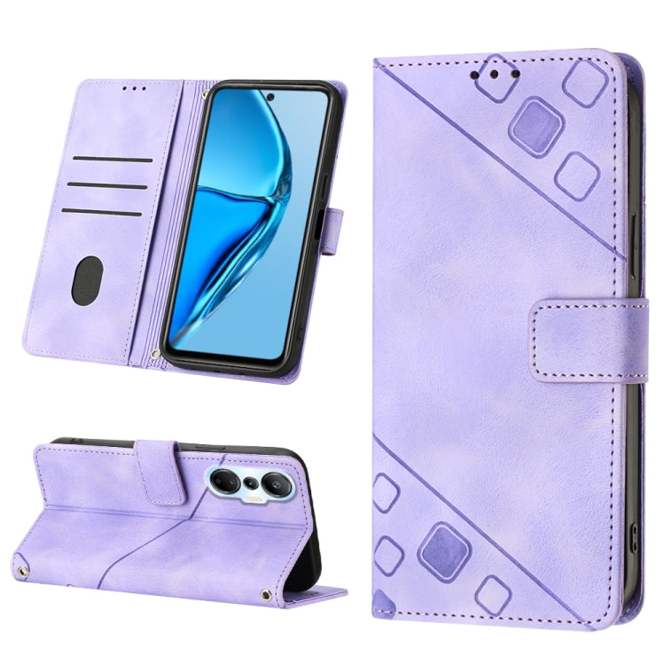 Skin-feel Embossed Leather Phone Case, For Infinix Hot 20 5G X666, For Infinix Hot 20 Play, For Infinix Hot 20S / 20 Pro X6827, For Infinix Note 11, For Infinix Note 11i / Note 10, For Infinix Note 11s / Note 11 Pro, For Infinix Note 12 G96            ...
