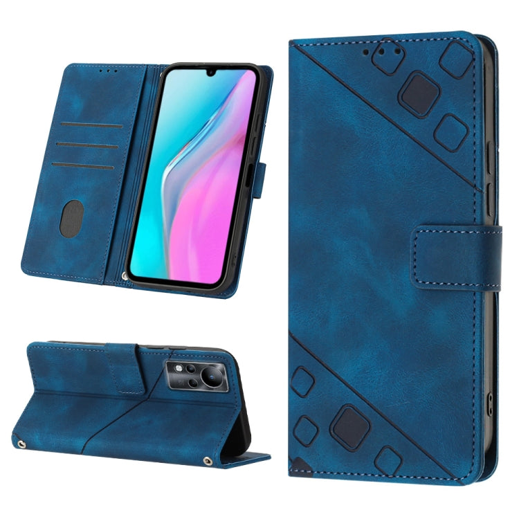 Skin-feel Embossed Leather Phone Case, For Infinix Hot 20 5G X666, For Infinix Hot 20 Play, For Infinix Hot 20S / 20 Pro X6827, For Infinix Note 11, For Infinix Note 11i / Note 10, For Infinix Note 11s / Note 11 Pro, For Infinix Note 12 G96            ...