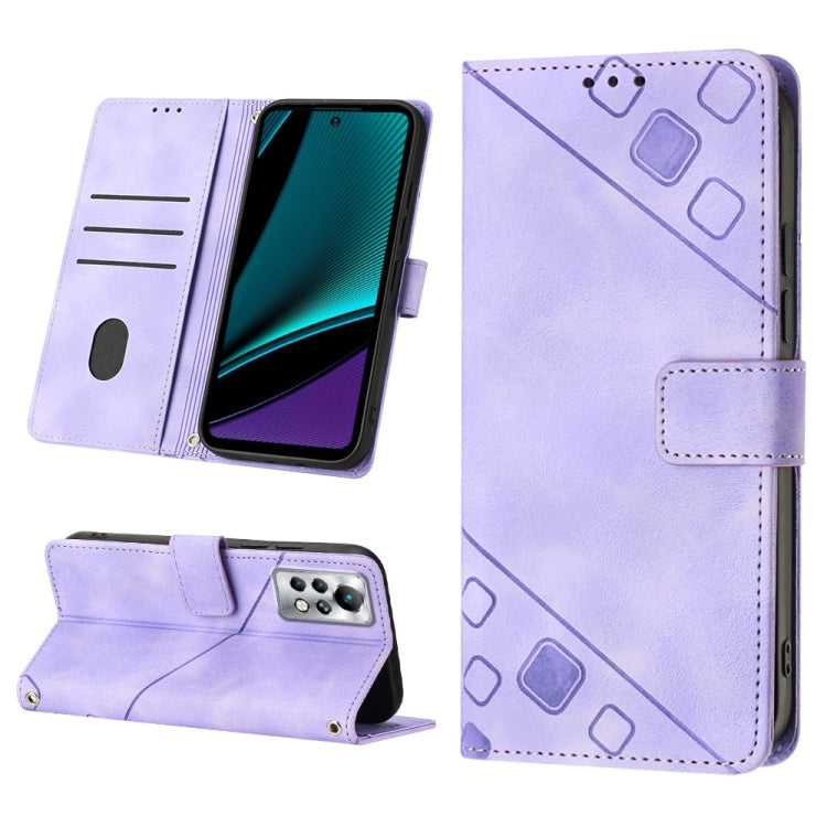 Skin-feel Embossed Leather Phone Case, For Infinix Hot 20 5G X666, For Infinix Hot 20 Play, For Infinix Hot 20S / 20 Pro X6827, For Infinix Note 11, For Infinix Note 11i / Note 10, For Infinix Note 11s / Note 11 Pro, For Infinix Note 12 G96            ...