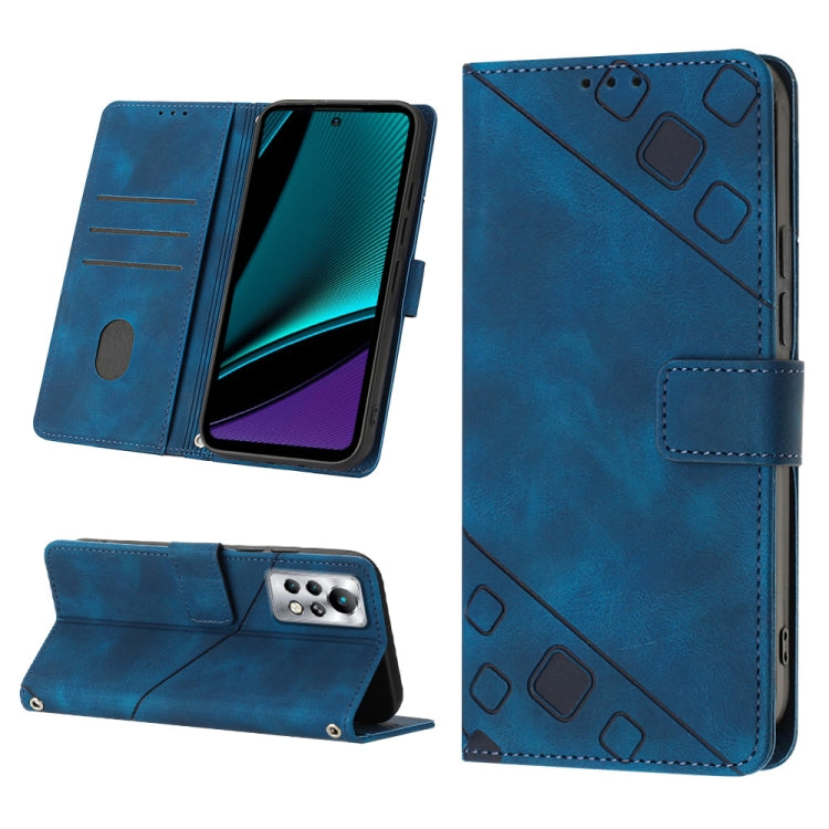 Skin-feel Embossed Leather Phone Case, For Infinix Hot 20 5G X666, For Infinix Hot 20 Play, For Infinix Hot 20S / 20 Pro X6827, For Infinix Note 11, For Infinix Note 11i / Note 10, For Infinix Note 11s / Note 11 Pro, For Infinix Note 12 G96            ...