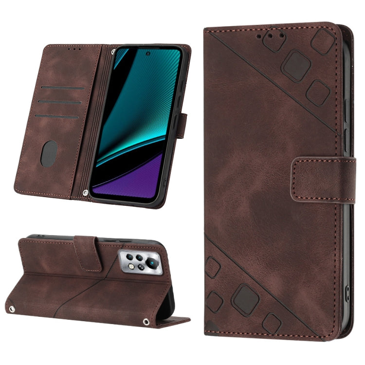 Skin-feel Embossed Leather Phone Case, For Infinix Hot 20 5G X666, For Infinix Hot 20 Play, For Infinix Hot 20S / 20 Pro X6827, For Infinix Note 11, For Infinix Note 11i / Note 10, For Infinix Note 11s / Note 11 Pro, For Infinix Note 12 G96            ...