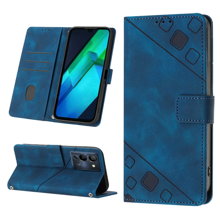 Skin-feel Embossed Leather Phone Case, For Infinix Hot 20 5G X666, For Infinix Hot 20 Play, For Infinix Hot 20S / 20 Pro X6827, For Infinix Note 11, For Infinix Note 11i / Note 10, For Infinix Note 11s / Note 11 Pro, For Infinix Note 12 G96            ...