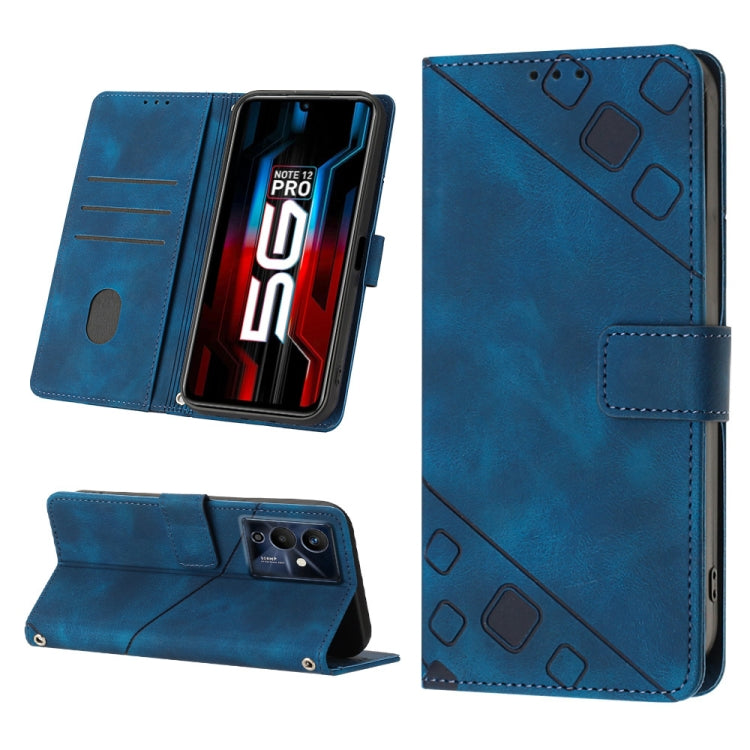 Skin-feel Embossed Leather Phone Case, For Infinix Note 12 5G / Note 12 Pro 5G, For Infinix Note 12i X6819, For Infinix Note 20 X676C, For Infinix Note 20i X665E, For Infinix Smart 6, For Infinix Smart 6 Plus X6823, For Infinix Smart 7 X6515           ...