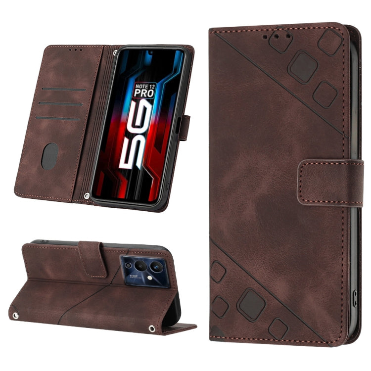 Skin-feel Embossed Leather Phone Case, For Infinix Note 12 5G / Note 12 Pro 5G, For Infinix Note 12i X6819, For Infinix Note 20 X676C, For Infinix Note 20i X665E, For Infinix Smart 6, For Infinix Smart 6 Plus X6823, For Infinix Smart 7 X6515           ...