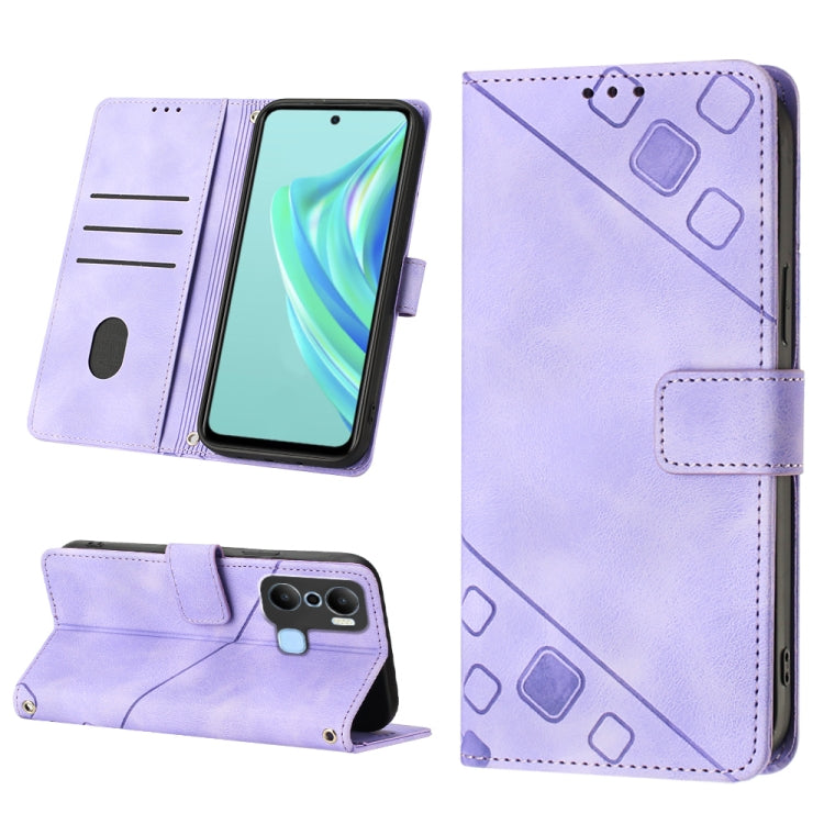 Skin-feel Embossed Leather Phone Case, For Infinix Note 12 5G / Note 12 Pro 5G, For Infinix Note 12i X6819, For Infinix Note 20 X676C, For Infinix Note 20i X665E, For Infinix Smart 6, For Infinix Smart 6 Plus X6823, For Infinix Smart 7 X6515           ...