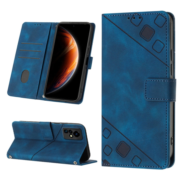 Skin-feel Embossed Leather Phone Case, For Infinix Note 12 5G / Note 12 Pro 5G, For Infinix Note 12i X6819, For Infinix Note 20 X676C, For Infinix Note 20i X665E, For Infinix Smart 6, For Infinix Smart 6 Plus X6823, For Infinix Smart 7 X6515           ...
