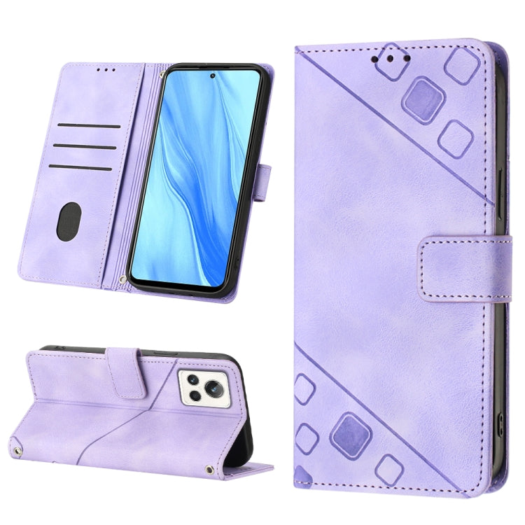 Skin-feel Embossed Leather Phone Case, For OPPO A96 5G / Reno7z / Reno7 Lite 5G / F21 Pro 5G / Reno8 z / OnePlus Nord N20, For OPPO K10X / Realme 9 Pro, For Realme 10, For Realme 10 5G, For Realme 10 Pro, For Realme C11, For Realme C33                 ...