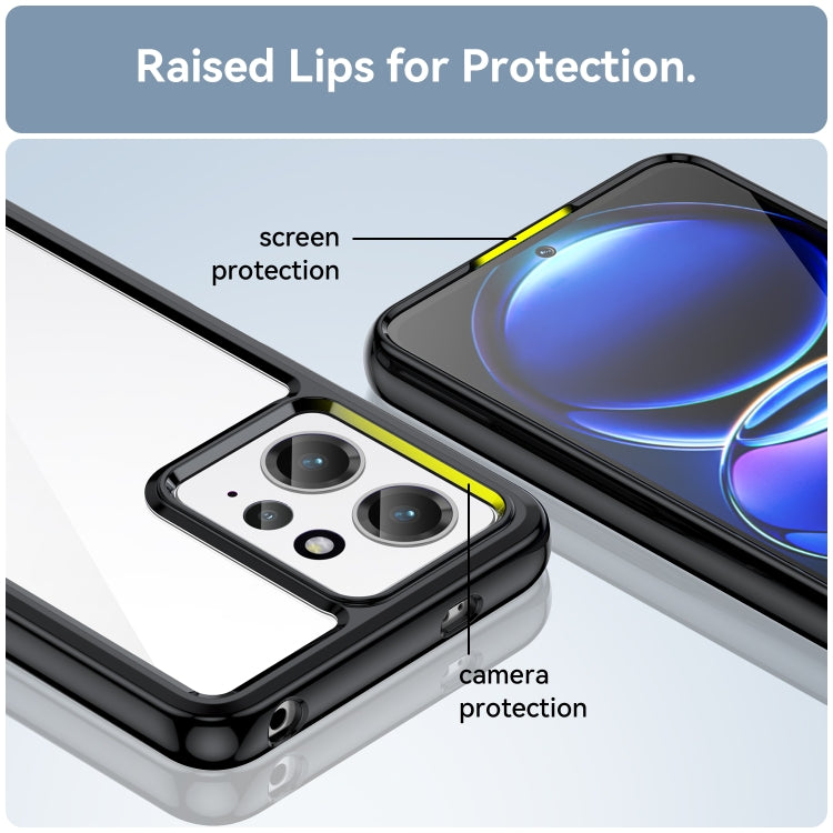 Colorful Series Acrylic + TPU Phone Case, For Xiaomi Redmi Note 12 4G Global