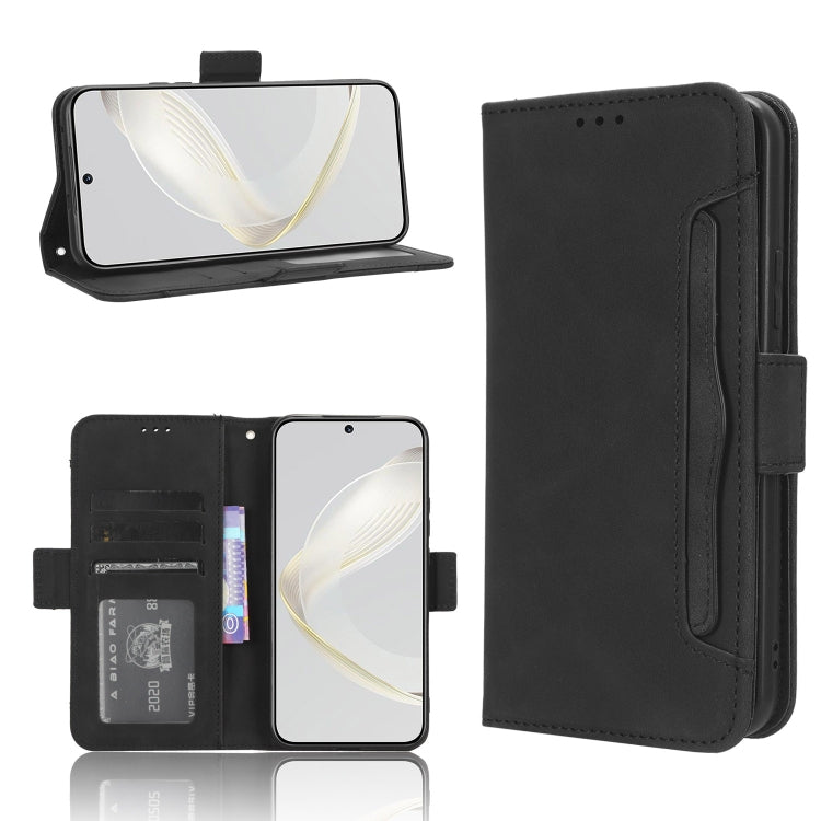 Skin Feel Calf Texture Card Slots Leather Phone Case, For Tecno Spark 10 Pro / K17, For Tecno Spark 10C, For vivo iQOO Z7x, For Infinix Hot 30 4G X6831, For Infinix Hot 30 Play, For Infinix Hot 30i / 30i NFC, For Doogee X97 / X97 Pro                   ...