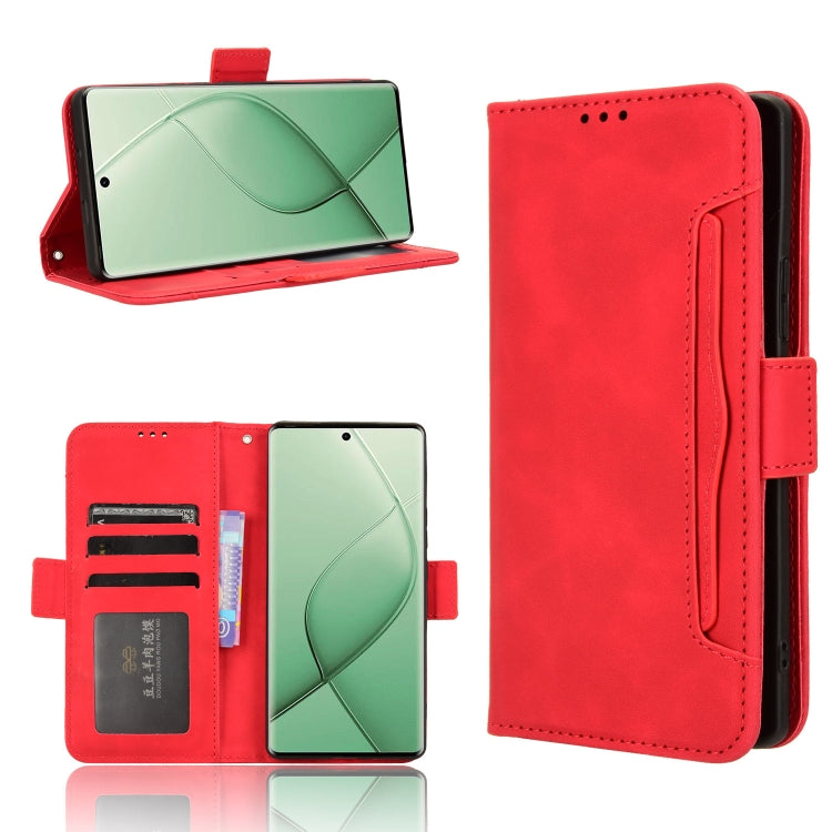 Skin Feel Calf Texture Card Slots Leather Phone Case, For Tecno Camon 30 Premier 5G, For Tecno Pova 6 Neo 4G, For Tecno Pova 6 4G, For Tecno Camon 30 Pro 5G, For Tecno Camon 30 5G / 4G, For Tecno Pova 6 Pro 5G, For Tecno Spark 20 Pro+ 4G KJ7           ...