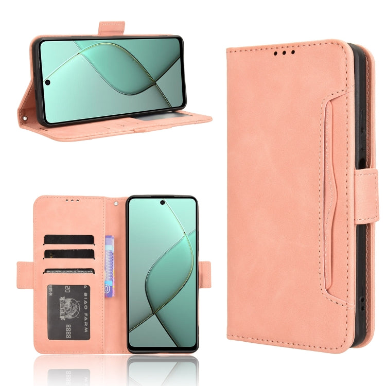 Skin Feel Calf Texture Card Slots Leather Phone Case, For Tecno Camon 40 Premier 5G, For Tecno Camon 40 4G, For Tecno Camon 30S 4G / 30S Pro 4G, For Tecno Pova 6 Neo 5G / Spark 30 5G, For Tecno Spark 30 Pro 4G, For Tecno Spark 30 4G                    ...