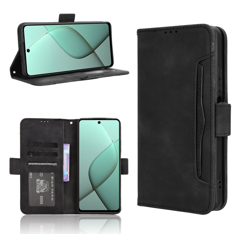 Skin Feel Calf Texture Card Slots Leather Phone Case, For Tecno Camon 40 Premier 5G, For Tecno Camon 40 4G, For Tecno Camon 30S 4G / 30S Pro 4G, For Tecno Pova 6 Neo 5G / Spark 30 5G, For Tecno Spark 30 Pro 4G, For Tecno Spark 30 4G                    ...