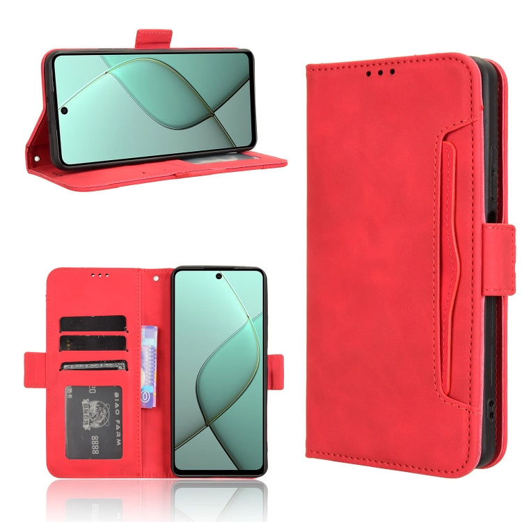Skin Feel Calf Texture Card Slots Leather Phone Case, For Tecno Camon 40 Premier 5G, For Tecno Camon 40 4G, For Tecno Camon 30S 4G / 30S Pro 4G, For Tecno Pova 6 Neo 5G / Spark 30 5G, For Tecno Spark 30 Pro 4G, For Tecno Spark 30 4G                    ...