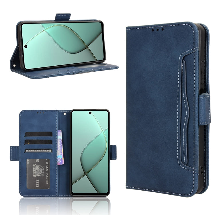 Skin Feel Calf Texture Card Slots Leather Phone Case, For Tecno Camon 40 Premier 5G, For Tecno Camon 40 4G, For Tecno Camon 30S 4G / 30S Pro 4G, For Tecno Pova 6 Neo 5G / Spark 30 5G, For Tecno Spark 30 Pro 4G, For Tecno Spark 30 4G                    ...