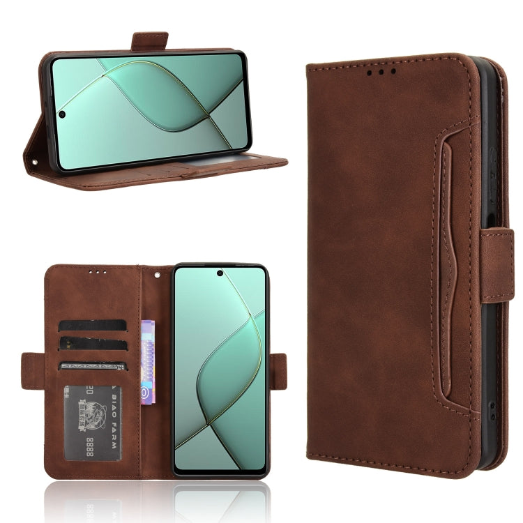 Skin Feel Calf Texture Card Slots Leather Phone Case, For Tecno Camon 40 Premier 5G, For Tecno Camon 40 4G, For Tecno Camon 30S 4G / 30S Pro 4G, For Tecno Pova 6 Neo 5G / Spark 30 5G, For Tecno Spark 30 Pro 4G, For Tecno Spark 30 4G                    ...