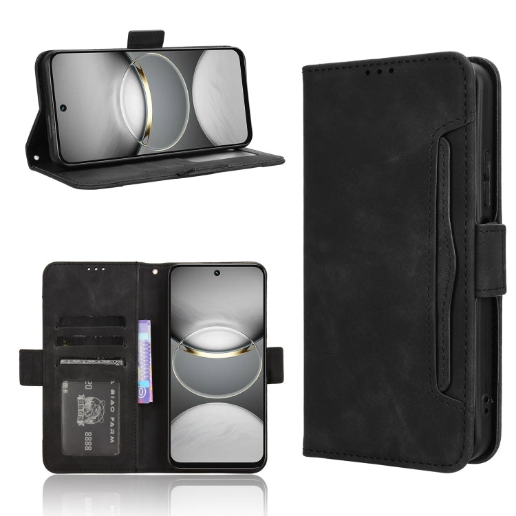 Skin Feel Calf Texture Card Slots Leather Phone Case, For Tecno Camon 40 Premier 5G, For Tecno Camon 40 4G, For Tecno Camon 30S 4G / 30S Pro 4G, For Tecno Pova 6 Neo 5G / Spark 30 5G, For Tecno Spark 30 Pro 4G, For Tecno Spark 30 4G                    ...