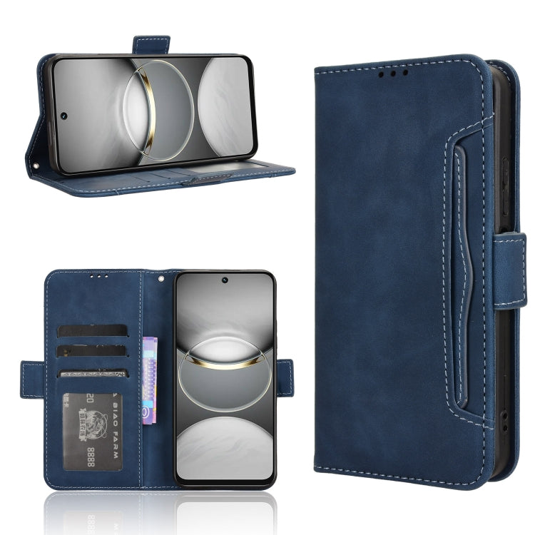 Skin Feel Calf Texture Card Slots Leather Phone Case, For Tecno Camon 40 Premier 5G, For Tecno Camon 40 4G, For Tecno Camon 30S 4G / 30S Pro 4G, For Tecno Pova 6 Neo 5G / Spark 30 5G, For Tecno Spark 30 Pro 4G, For Tecno Spark 30 4G                    ...