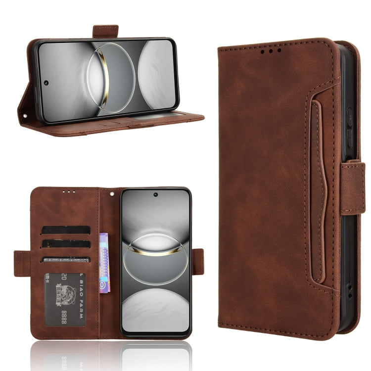 Skin Feel Calf Texture Card Slots Leather Phone Case, For Tecno Camon 40 Premier 5G, For Tecno Camon 40 4G, For Tecno Camon 30S 4G / 30S Pro 4G, For Tecno Pova 6 Neo 5G / Spark 30 5G, For Tecno Spark 30 Pro 4G, For Tecno Spark 30 4G                    ...