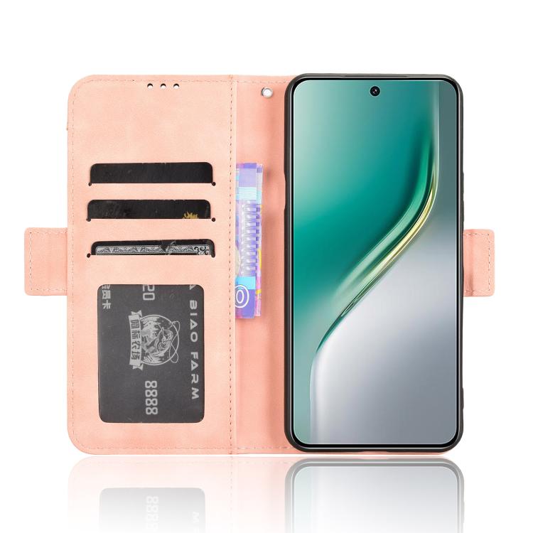 Skin Feel Calf Texture Card Slots Leather Phone Case, For Tecno Camon 40 Premier 5G, For Tecno Camon 40 4G, For Tecno Camon 30S 4G / 30S Pro 4G, For Tecno Pova 6 Neo 5G / Spark 30 5G, For Tecno Spark 30 Pro 4G, For Tecno Spark 30 4G                    ...