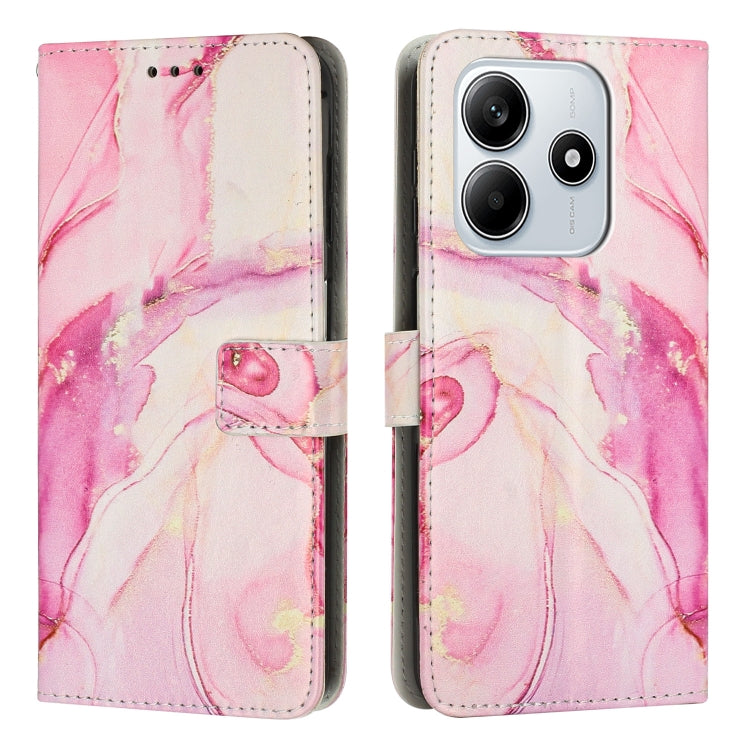 Painted Marble Pattern Leather Phone Case, For Redmi Note 15 Pro 5G Global 163.6mm, For Redmi 15C 5G / 4G EU 173mm / Poco C85 5G, For Redmi 15 5G Global / 15 4G SEA 169.5mm, For Redmi 15 5G / 4G EU 171mm, For Redmi 15C 5G / 4G Global 171mm             ...