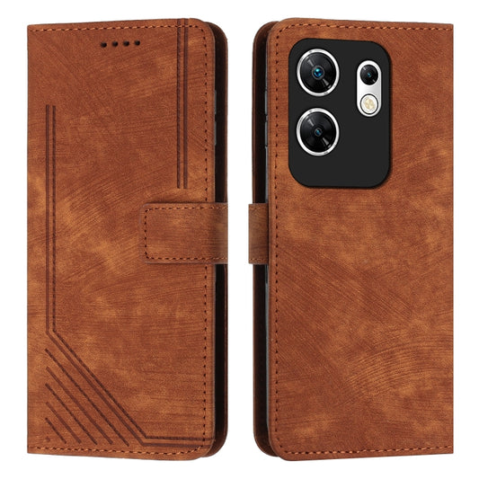 Skin Feel Stripe Pattern Leather Phone Case with Lanyard, For Infinix Zero 30 4G, For Infinix Zero 30 5G, For Infinix Hot 30 Play NFC, For Infinix Note 30/Note 30 5G, For Infinix Note 30i, For Infinix Note 30 Pro, For Infinix Note 30 VIP               ...