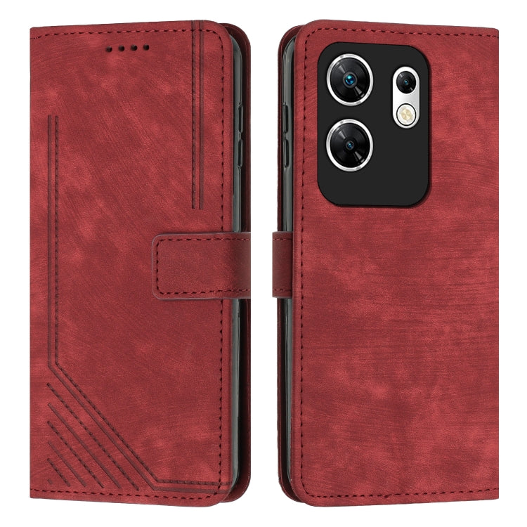 Skin Feel Stripe Pattern Leather Phone Case with Lanyard, For Infinix Smart 8, For Infinix Zero 30 4G, For Infinix Zero 30 5G, For Infinix Hot 30 Play NFC, For Infinix Note 30/Note 30 5G, For Infinix Note 30i, For Infinix Note 30 Pro                   ...
