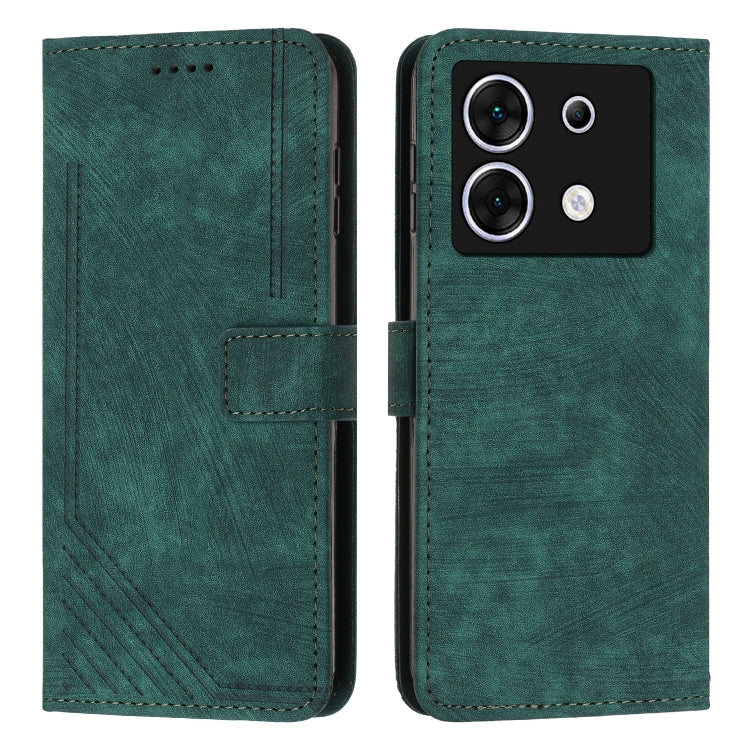 Skin Feel Stripe Pattern Leather Phone Case with Lanyard, For Infinix Smart 8, For Infinix Zero 30 4G, For Infinix Zero 30 5G, For Infinix Hot 30 Play NFC, For Infinix Note 30/Note 30 5G, For Infinix Note 30i, For Infinix Note 30 Pro                   ...